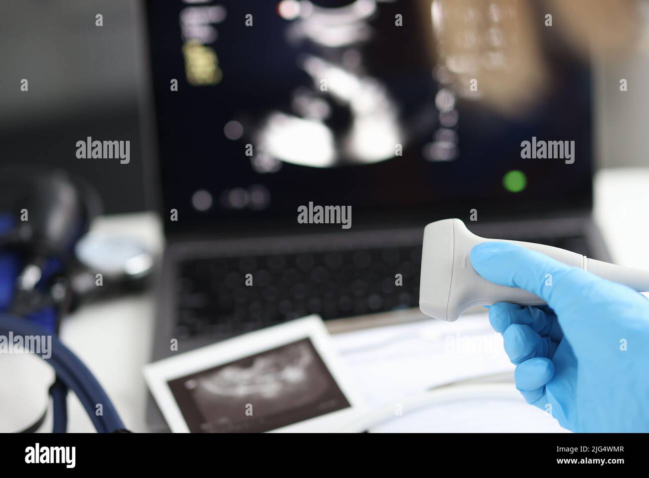 Il medico tiene la sonda a ultrasuoni in mano preparando il dispositivo per l'esame Foto Stock