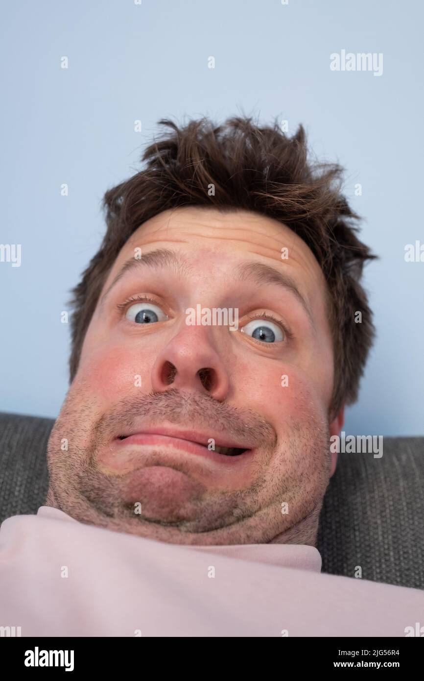 Giovane con un doppio mento. Il risultato di uno stile di vita povero Foto Stock
