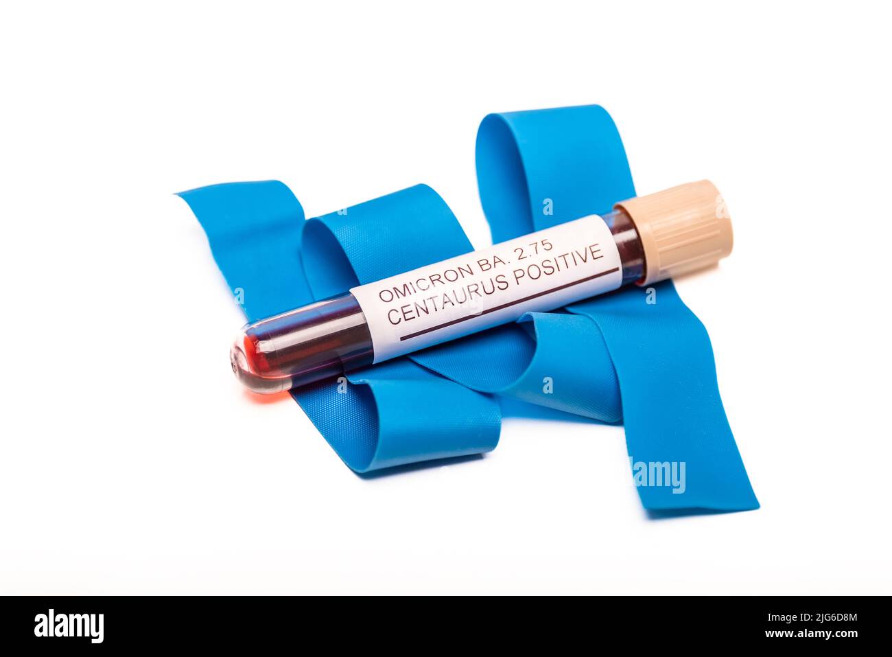 Coronavirus 2019-nCoV variante CENTAURUS BA.2,75 campione di sangue. Nuova epidemia Corona Virus. Foto Stock
