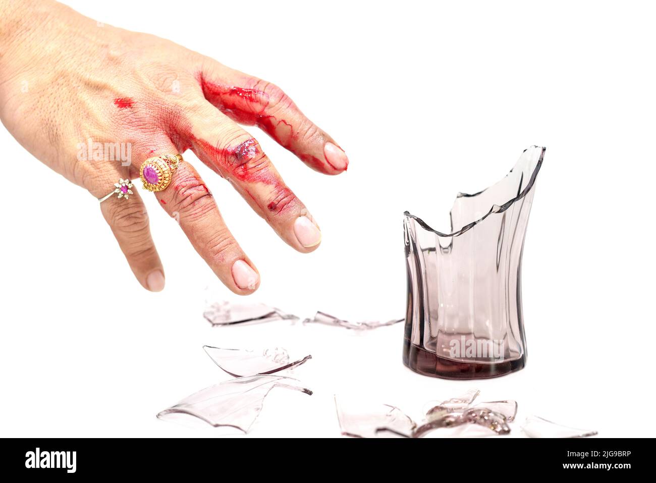 Lesioni alle mani ravvicinate, lesioni con coltello, vetro, oggetti appuntiti, mano sanguinosa reale. Foto Stock