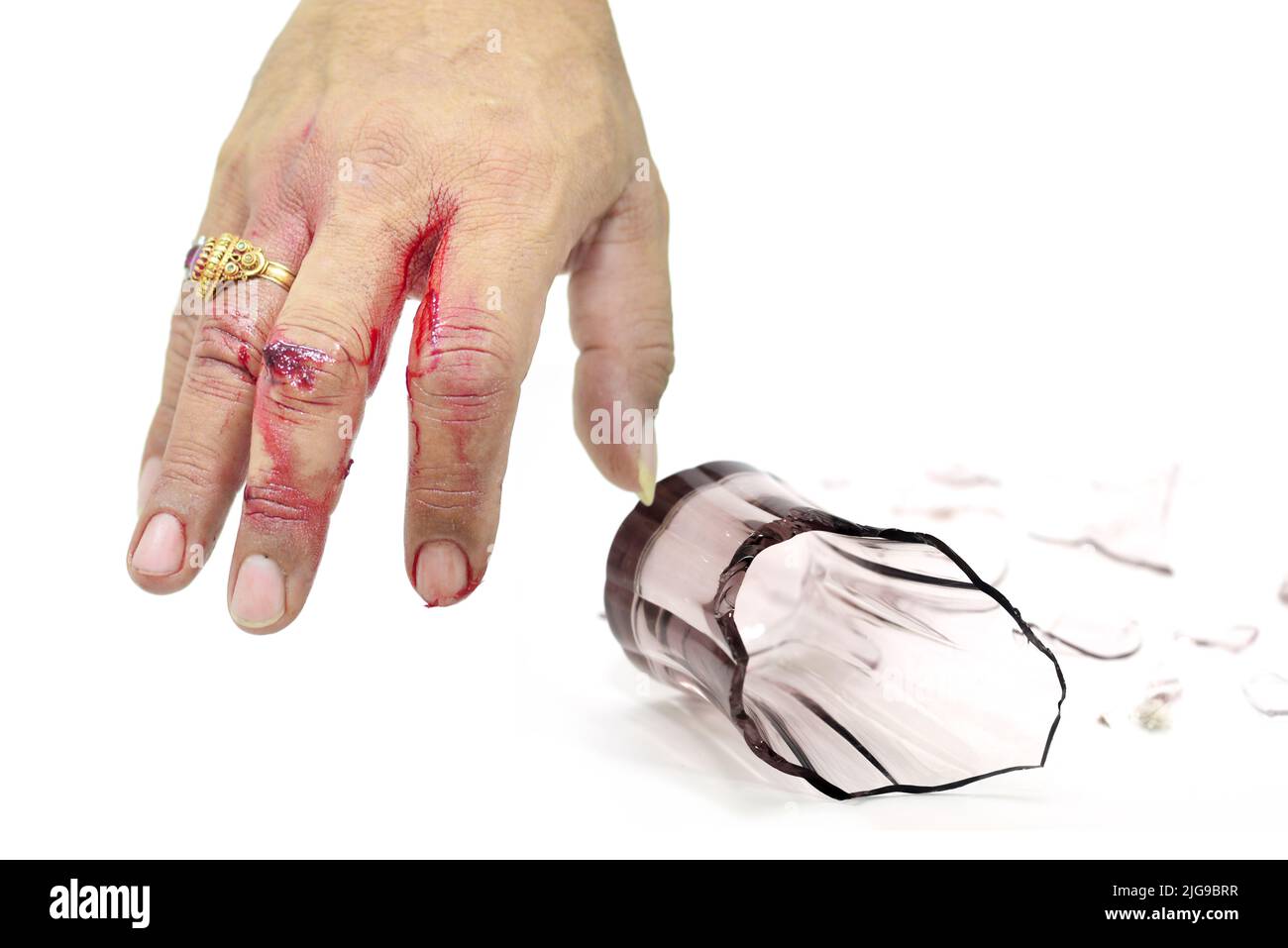 Lesioni alle mani ravvicinate, lesioni con coltello, vetro, oggetti appuntiti, mano sanguinosa reale. Foto Stock