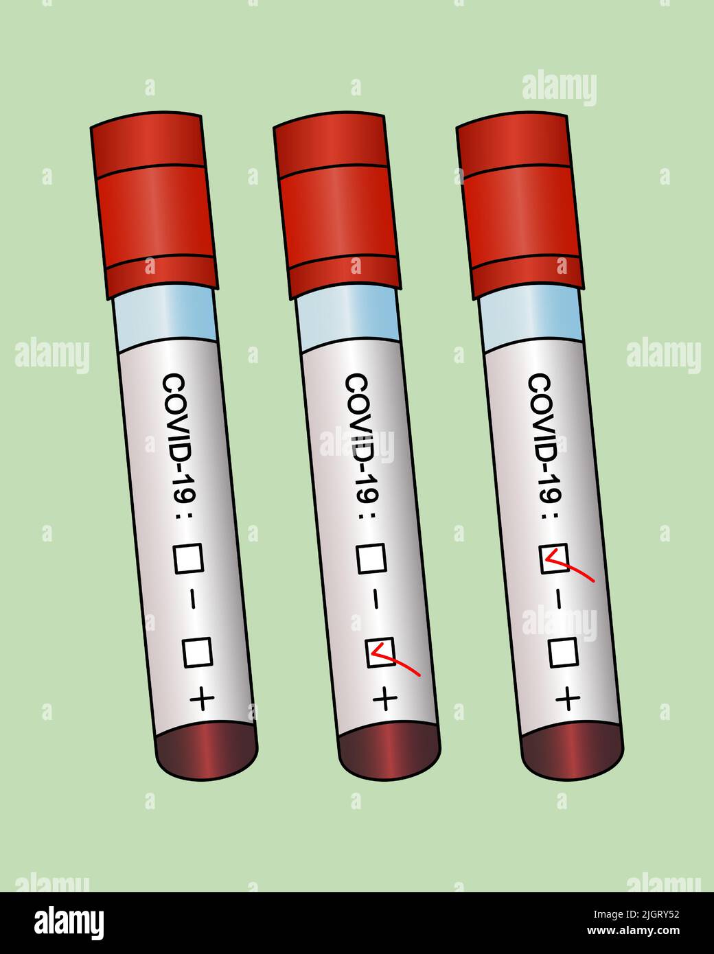Provette con analisi del paziente. Set vettoriale. Diagnosi di campioni di sangue per l'infezione da coronavirus. Tre risultati positivi, negativi, non preparati. Illustrazione Vettoriale