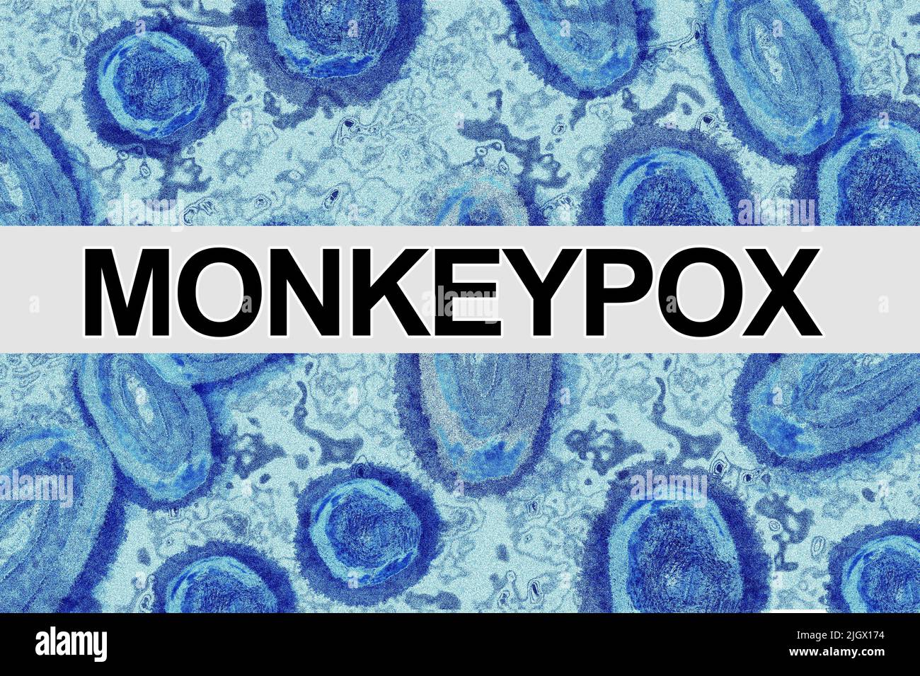 Virus Monkeypox al microscopio, colore blu, con banner di testo Foto Stock