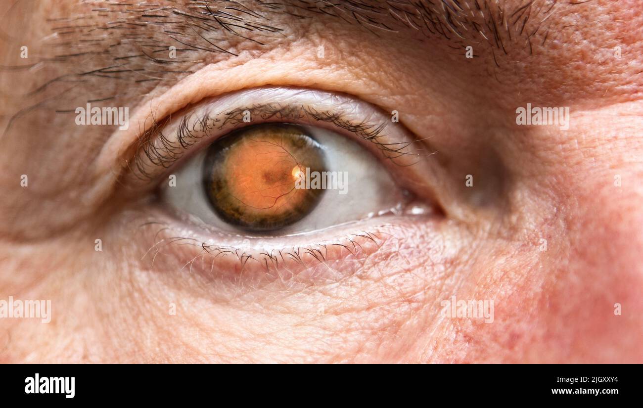 Primo piano dell'occhio con retina visibile Foto Stock