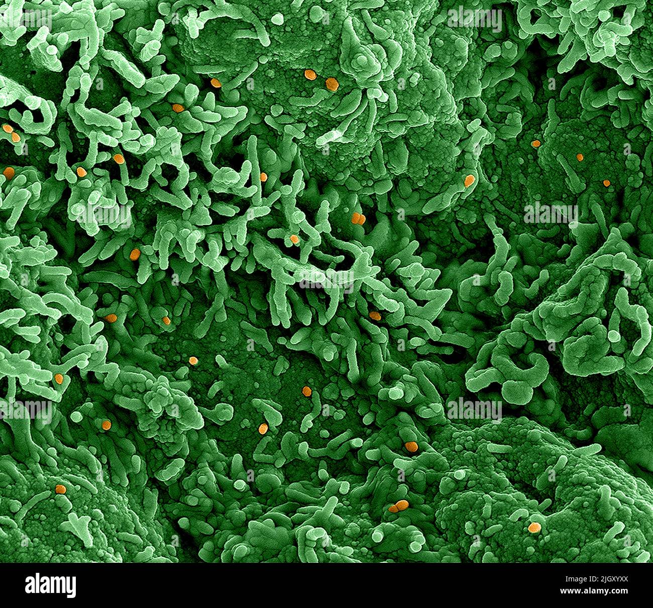 Monkeypox. Micrografia elettronica a trasmissione colorata di particelle di virus Nipah extracellulari (rosse) mature vicino alla periferia di una cellula di vero infettata (blu e verde). Immagine catturata presso lo stabilimento di ricerca integrato NIAID di Fort Detrick, Maryland. Credit NIAID Monkeypox è una malattia virale infettiva che può verificarsi negli esseri umani e in alcuni altri animali.i sintomi includono febbre, linfonodi gonfi, e un rash che forma vescicole e poi croste sopra. Il tempo che va dall'esposizione all'insorgenza dei sintomi varia da 5 a 21 giorni. La durata dei sintomi è tipicamente da 2 a 4 settimane. Foto Stock