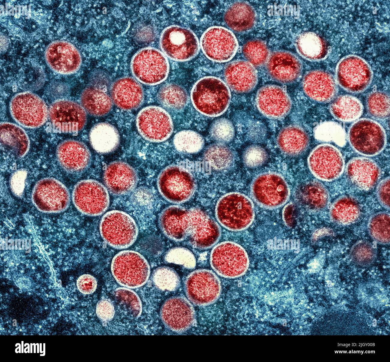 Monkeypox. Micrografia elettronica a trasmissione colorata di particelle di virus Nipah extracellulari (rosse) mature vicino alla periferia di una cellula di vero infettata (blu e verde). Immagine catturata presso lo stabilimento di ricerca integrato NIAID di Fort Detrick, Maryland. Credit NIAID Monkeypox è una malattia virale infettiva che può verificarsi negli esseri umani e in alcuni altri animali.i sintomi includono febbre, linfonodi gonfi, e un rash che forma vescicole e poi croste sopra. Il tempo che va dall'esposizione all'insorgenza dei sintomi varia da 5 a 21 giorni. La durata dei sintomi è tipicamente da 2 a 4 settimane. Foto Stock