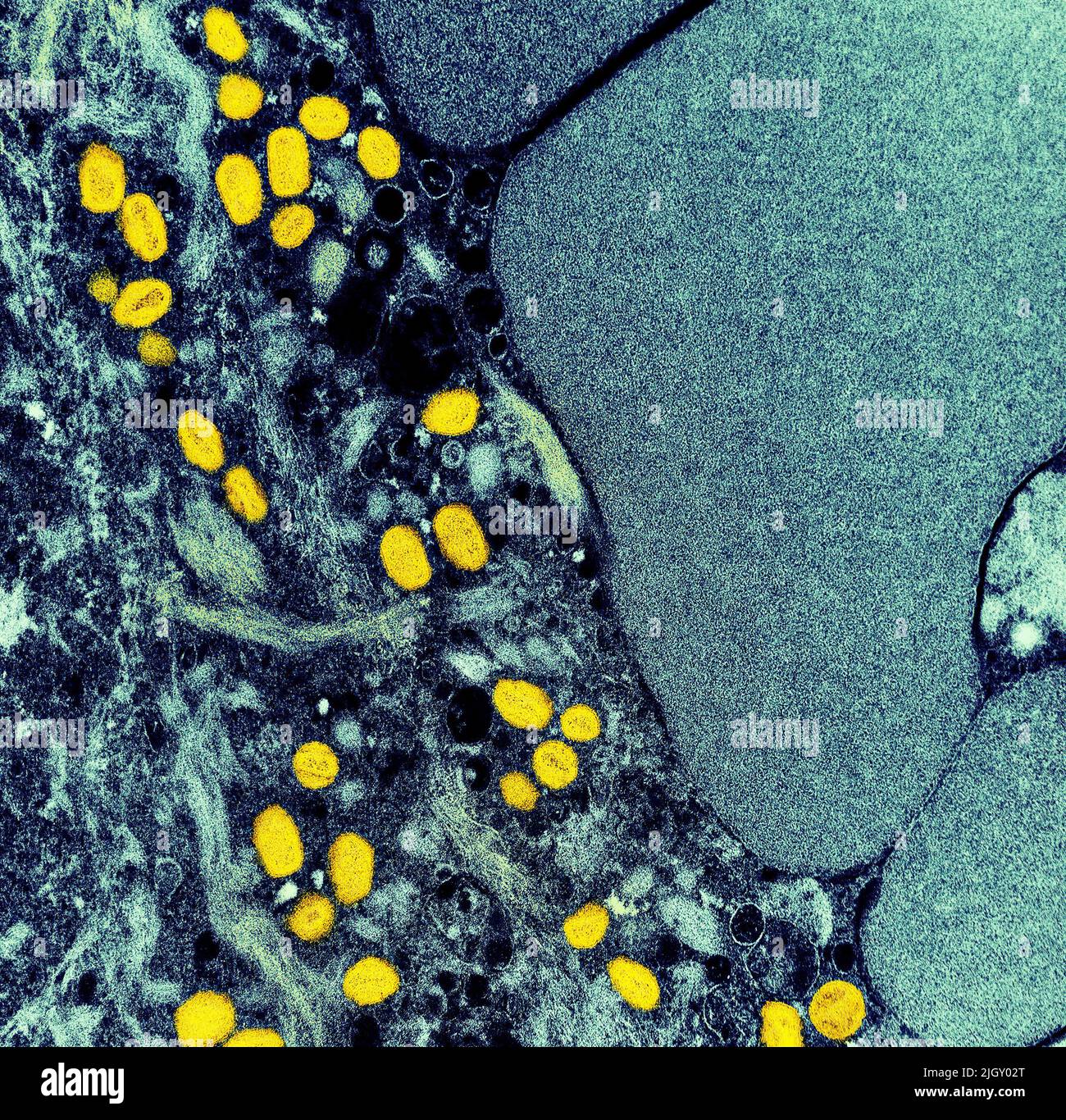 Monkeypox. Micrografia elettronica a trasmissione colorata di particelle di virus Nipah extracellulari (rosse) mature vicino alla periferia di una cellula di vero infettata (blu e verde). Immagine catturata presso lo stabilimento di ricerca integrato NIAID di Fort Detrick, Maryland. Credit NIAID Monkeypox è una malattia virale infettiva che può verificarsi negli esseri umani e in alcuni altri animali.i sintomi includono febbre, linfonodi gonfi, e un rash che forma vescicole e poi croste sopra. Il tempo che va dall'esposizione all'insorgenza dei sintomi varia da 5 a 21 giorni. La durata dei sintomi è tipicamente da 2 a 4 settimane. Foto Stock