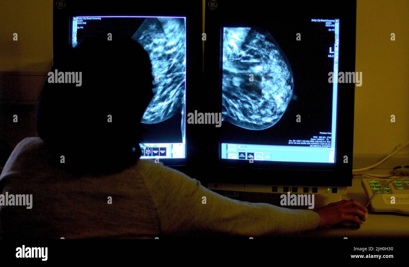 Foto di archivio datata 15/06/06 di un consulente che studia un mammogramma. Migliaia di pazienti affetti da cancro al seno devono beneficiare di due nuovi farmaci che devono essere messi a disposizione attraverso il sistema sanitario nazionale. Circa 3.000 donne all'anno beneficeranno della droga che estende la vita Aldelisib, ha annunciato l'NHS. E 650 pazienti con un certo tipo di cancro al seno avranno accesso a Trodelvy, che è stato finalmente dato il via libera per l'uso di NHS, nonostante essere preliminarmente rifiutato all'inizio di quest'anno. Data di emissione: Giovedì 14 luglio 2022. Foto Stock