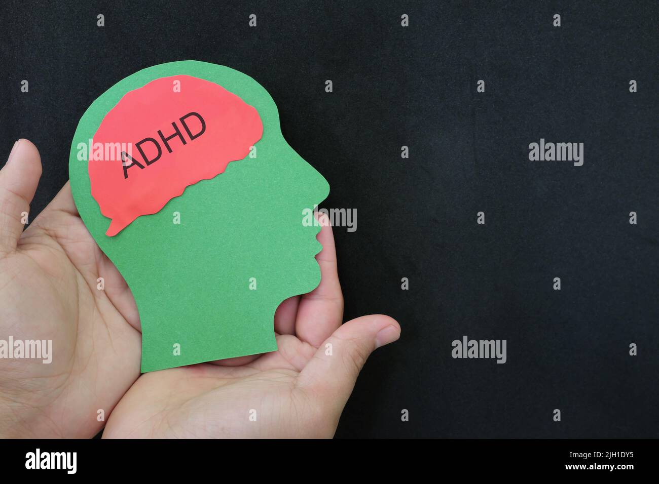 Cura del paziente, recupero, terapia e trattamento del paziente ADHD. Mano che tiene il profilo della testa umana con il testo della parola sul cervello. Foto Stock