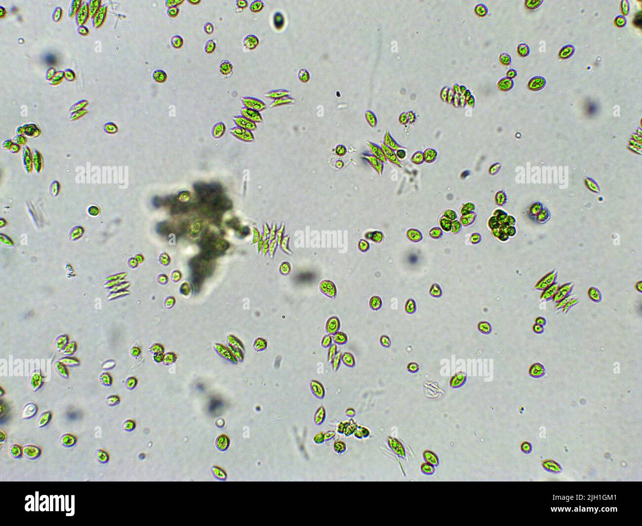 Scenedesmus sp. Alghe verdi sotto vista microscopica Foto Stock