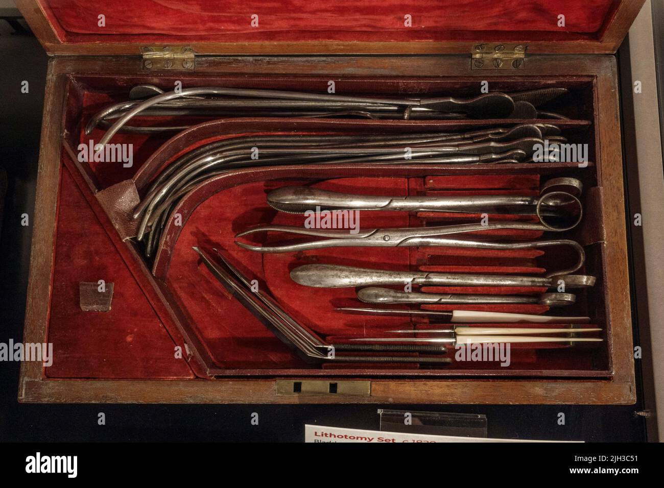 Un set di litotomia pre-vittoriana (c 1820s) (utilizzato per la rimozione della pietra vescicale attraverso la perinea) in esposizione al Thackray Museum of Medicine, Leeds, Regno Unito. Foto Stock