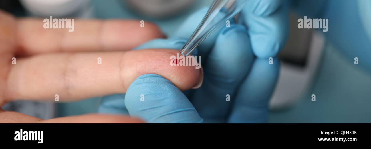 Il medico prende il sangue del dito del cliente con la provetta di vetro, procedura usuale alla clinica Foto Stock