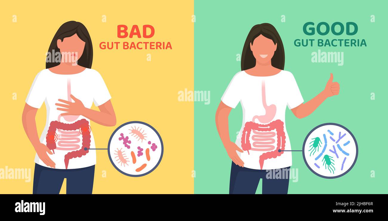 Batteri buoni e cattivi dell'intestino: Differenza tra flora intestinale bilanciata e disbiosi intestinale Illustrazione Vettoriale