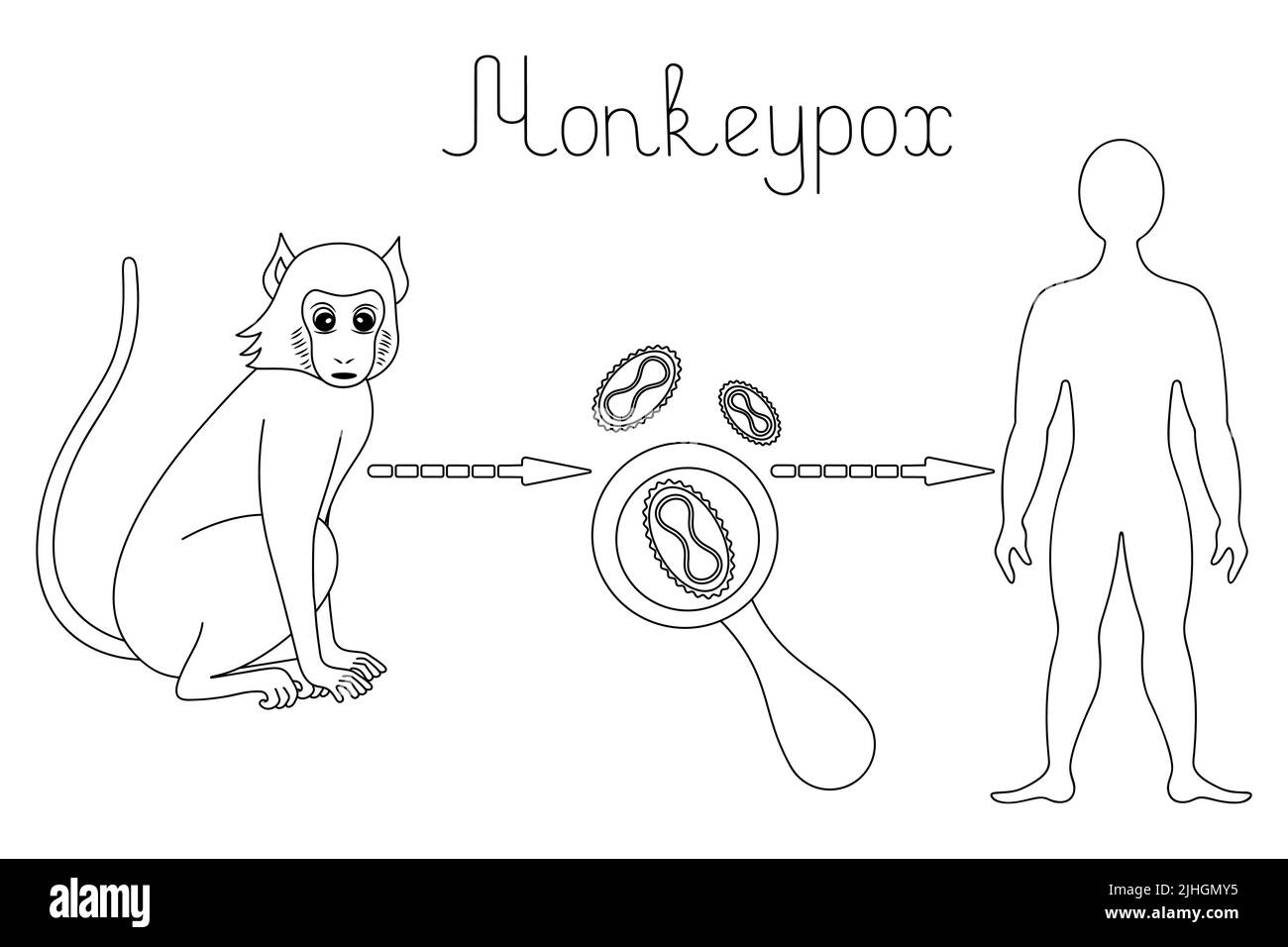 Monkey – virus del vaiolo – umano, uno schema di infezione umana con il virus del vaiolo di scimmia nello stile di scarabocchi Illustrazione Vettoriale