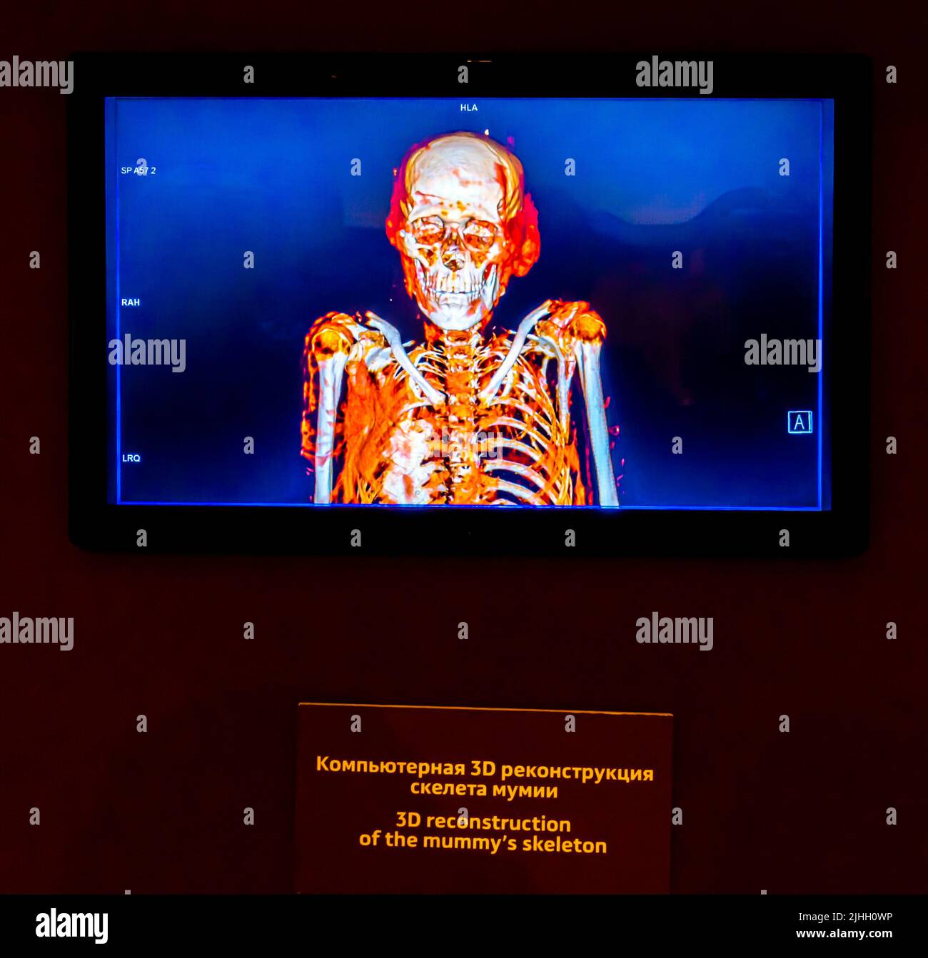 3D ricostruzione dello scheletro di un'antica mummia egiziana dal museo dell'Hermitage a San Pietroburgo. Foto Stock