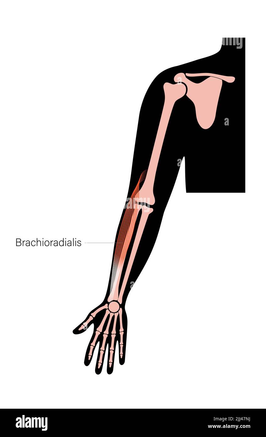 Anatomia muscolare di Brachioradialis, illustrazione. Foto Stock