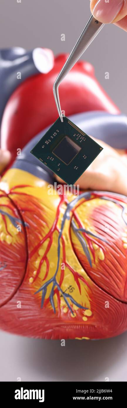 Modello di cuore con pacemaker cardiaco in forma di chip Foto Stock