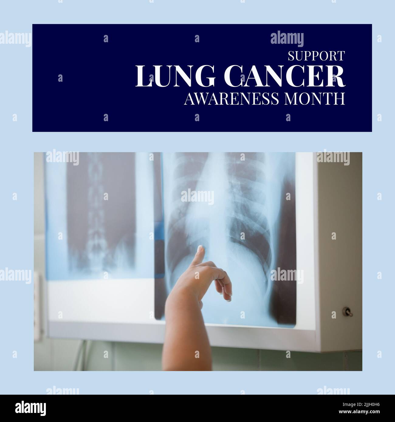 Immagine del concetto di consapevolezza del cancro ai polmoni sopra le mani del medico caucasico che mostra la foto a raggi X. Foto Stock