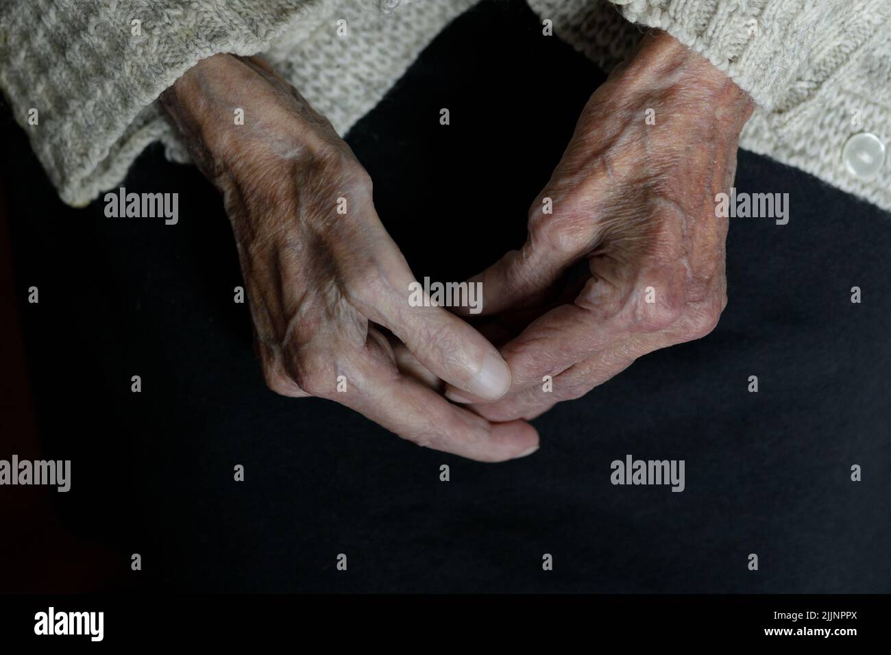 Mani di una vecchia donna su sfondo nero. Processo di invecchiamento. Foto Stock