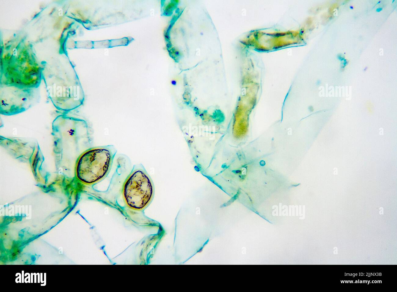 Gli eterocisti di Anabaena osservati al microscopio a 100x. Foto Stock