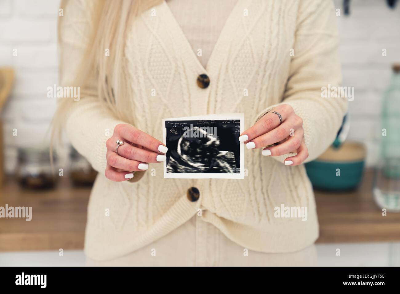 Donna bianca non riconoscibile che indossa un maglione a maglia che tiene la foto a ultrasuoni del bambino alla fotocamera. Primo piano scatto interno. Foto di alta qualità Foto Stock