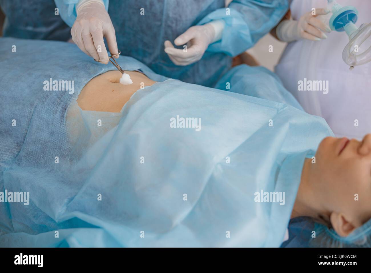 L'infermiere e il medico preparano la pelle del paziente per l'intervento chirurgico utilizzando una soluzione antisettica Foto Stock