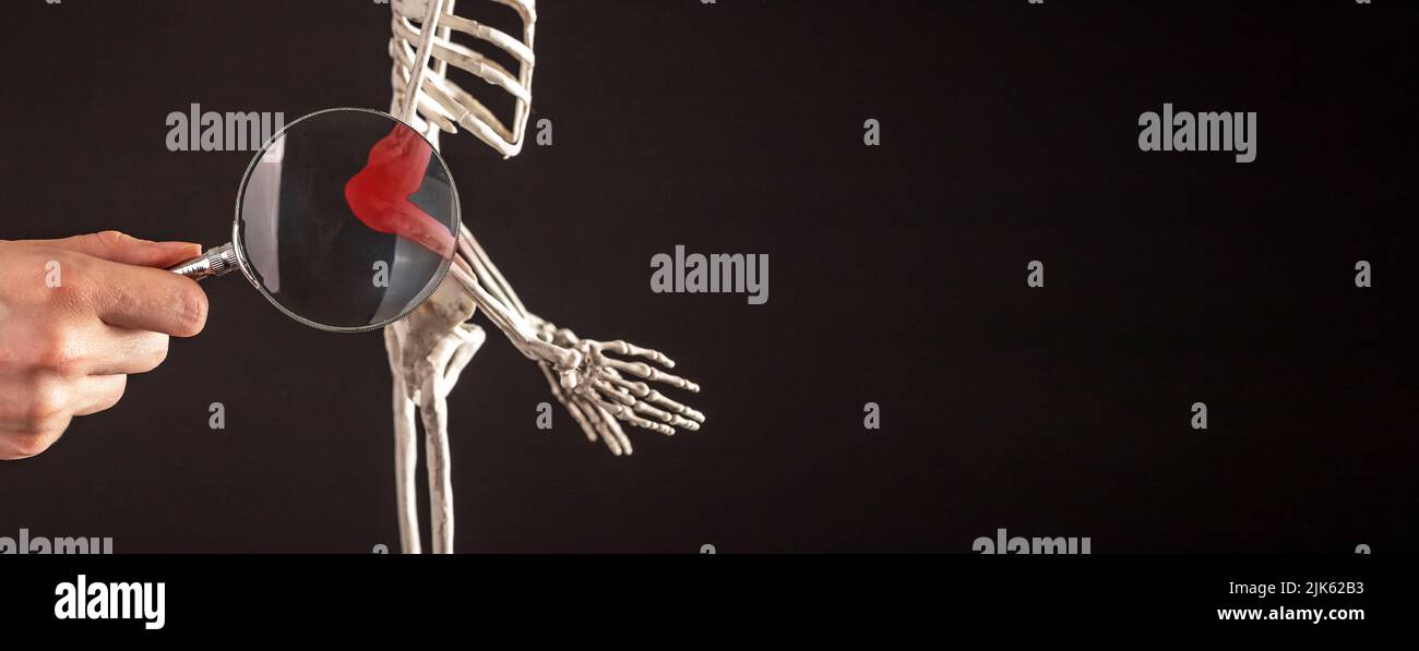 Banner con mano con lente di ingrandimento sulle ossa del gomito dello scheletro umano con punta rossa. Umero, raggio, ulna. Dolore al braccio, concetto di studio anatomico. Spazio di copia. Foto di alta qualità Foto Stock