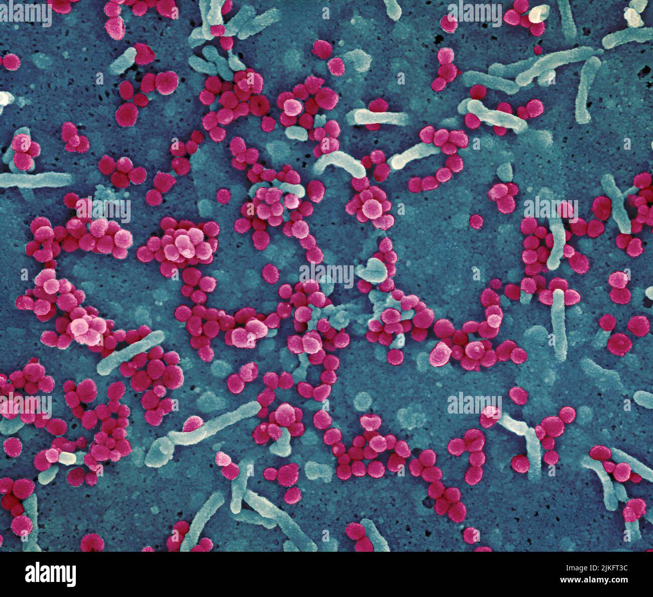 Microsografia elettronica a scansione del virus Lassa che germogliano da una cellula. Il virus Lassa (LASV) è un arenavirus che provoca la febbre emorragica di Lassa, un tipo di febbre emorragica virale (VHF) nell'uomo e in altri primati. Immagine richiesta dal NIAID Integrated Research Facility (IRF) a Fort Detrick, Maryland. Credito: NIAID Foto Stock