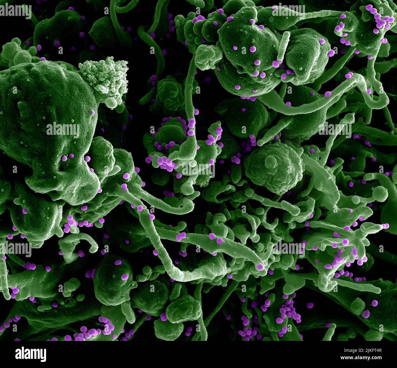 Microsografia elettronica a scansione del virus Lassa che germogliano da una cellula. Il virus Lassa (LASV) è un arenavirus che provoca la febbre emorragica di Lassa, un tipo di febbre emorragica virale (VHF) nell'uomo e in altri primati. Immagine acquistata e colorata dal NIAID Integrated Research Facility (IRF) a Fort Detrick, Maryland. Credito: NIAID Foto Stock