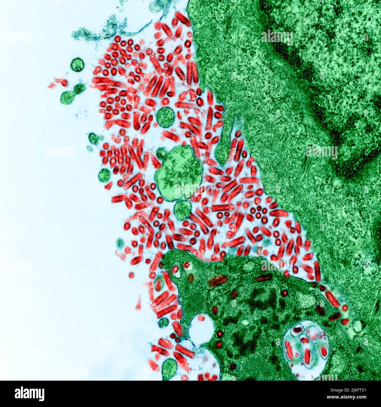 Micrografia elettronica a trasmissione colorata di cellule BSK coltivate pesantemente infettate con virus della rabbia. Immagine acquistata e migliorata dal colore presso il NIAID Integrated Research Facility (IRF) a Fort Detrick, Maryland. Credito: NIAID Foto Stock