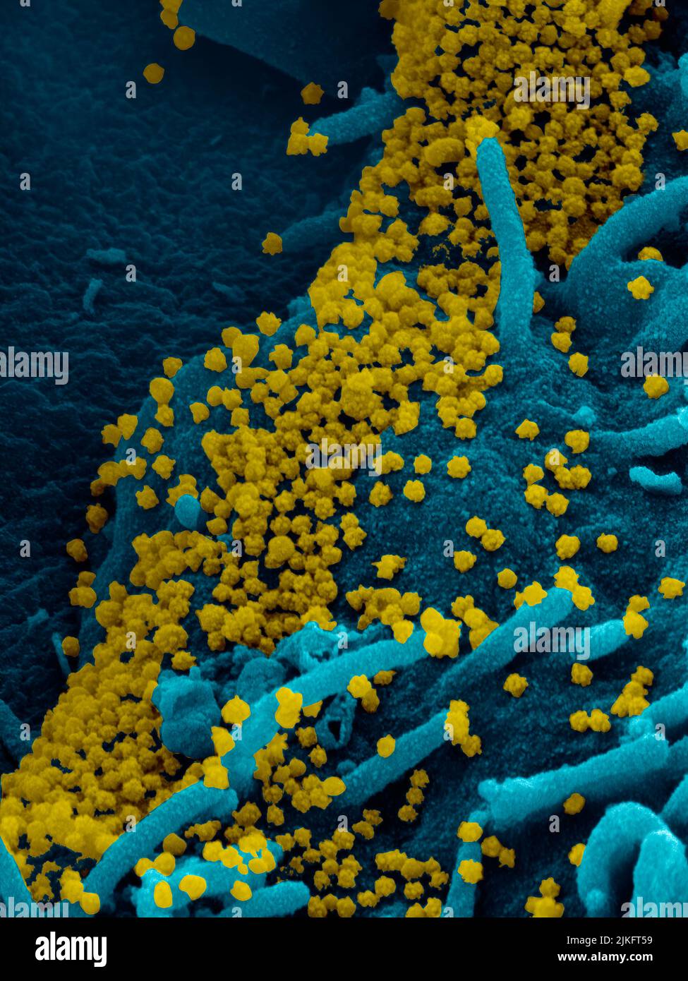 Questa immagine al microscopio elettronico a scansione mostra SARS-COV-2 (particelle d'oro rotonde) che emergono dalla superficie di una cellula coltivata in laboratorio. SARS-cov-2, noto anche come 2019-nCoV, è il virus che causa COVID-19. Immagine catturata e colorata presso i Rocky Mountain Laboratories di Hamilton, Montana. Credito: NIAID Foto Stock