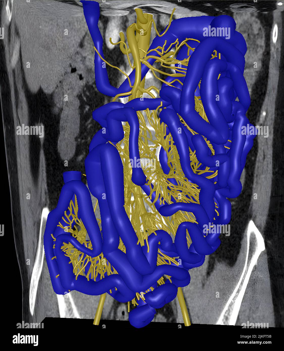 Questa immagine mostra i 3D modelli della vascolatura dell'intestino tenue (giallo) e dell'intestino tenue (blu) ottenuti da scansioni TC abdominopelviche con contrasto ad altissima risoluzione. Foto Stock