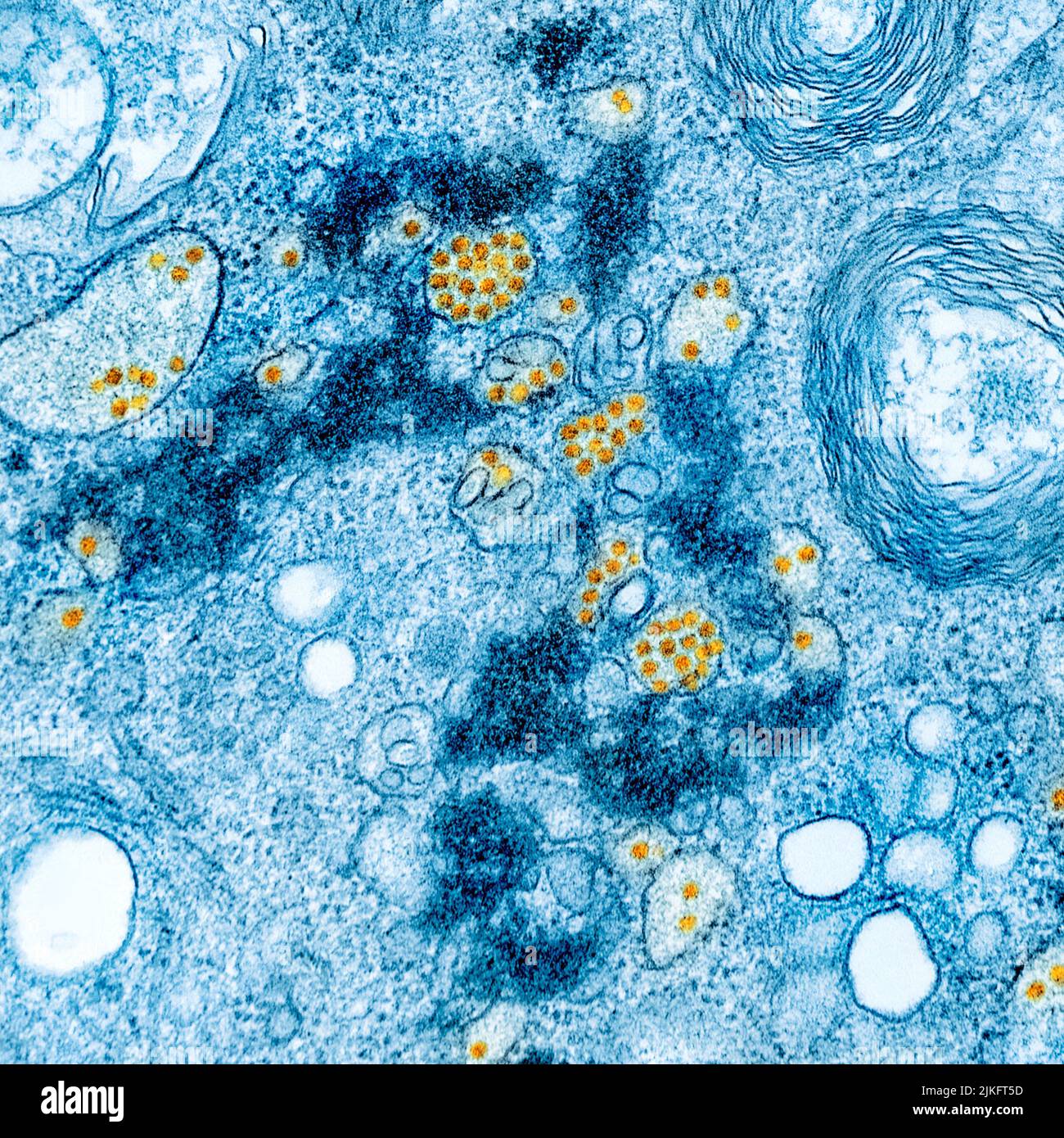 Micrografia elettronica a trasmissione colorata di cellule vero E6 coltivate infettate con particelle di virus della febbre gialla che si trovano in regioni distese del reticolo endoplasmatico. Immagine acquistata e migliorata dal colore presso il NIAID Integrated Research Facility (IRF) a Fort Detrick, Maryland. Credito: NIAID Foto Stock