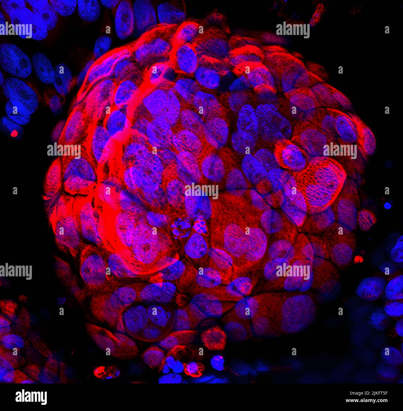 Una perla ricoperta di trofoblasti (colorati di rosso con citocheratina-19). I nuclei sono in blu. Foto Stock