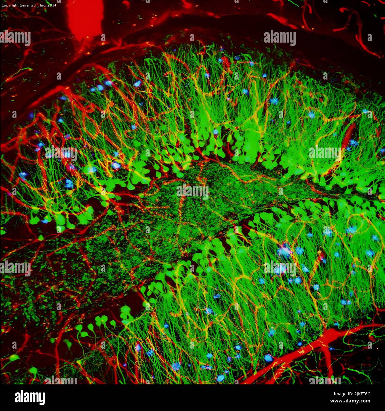 Oltre ai vasi sanguigni (rossi) e alle cellule nervose (verdi), questo cervello di topo ha clumps anormali delle proteine chiamate placche (blu). Queste placche si moltiplicano nel cervello delle persone con il morbo di Alzheimer e. Foto Stock