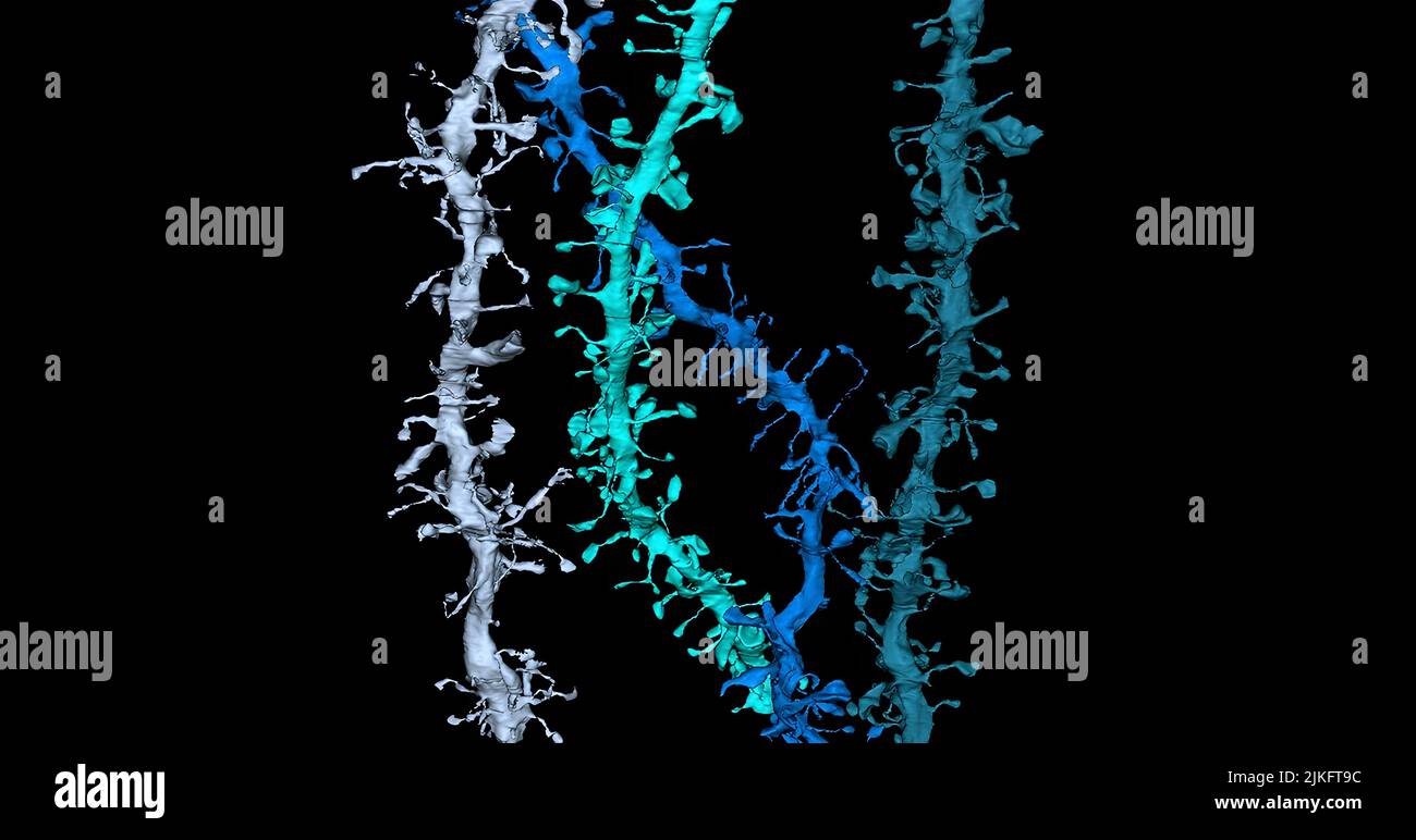 I neuroni ricevono informazioni da altri neuroni attraverso sinapsi, la maggior parte dei quali sono contenuti lungo dendriti su minuscoli proiezioni chiamate spine. Foto Stock
