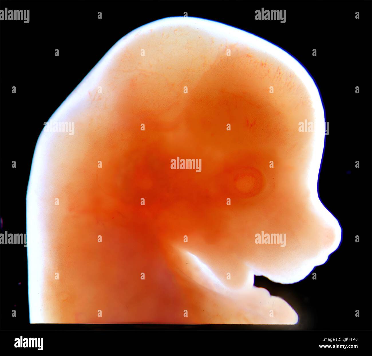 Regione craniofacciale di un embrione di topo di 13 giorni mediante microscopia a luce trasmessa. Foto Stock