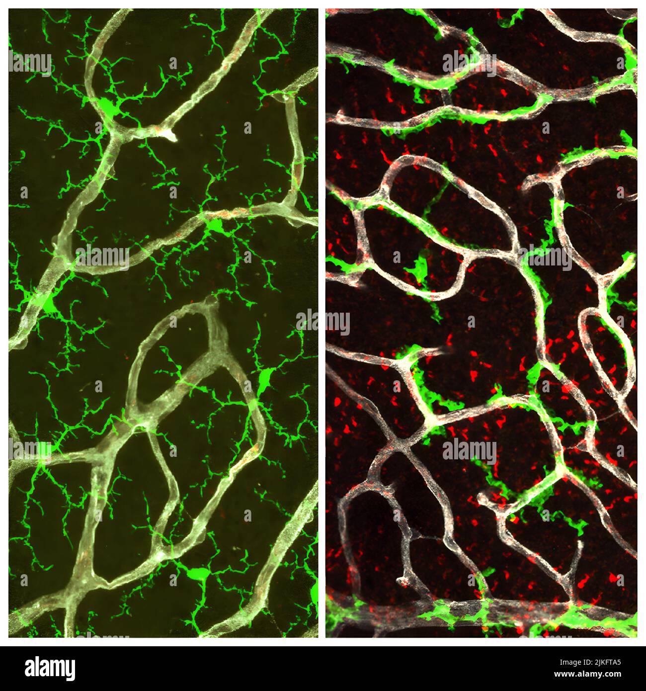 Nella retina sana (sinistra), le microglia (verde) hanno una struttura ramificata che copre la retina. Senza segnalazione TGF' (destra), i microglia perdono la loro struttura ramificata e si attaccano ai vasi sanguigni (bianco). La glia di M'ller è diventata anomala e ha acquisito marcatori di attivazione (rosso). Foto Stock