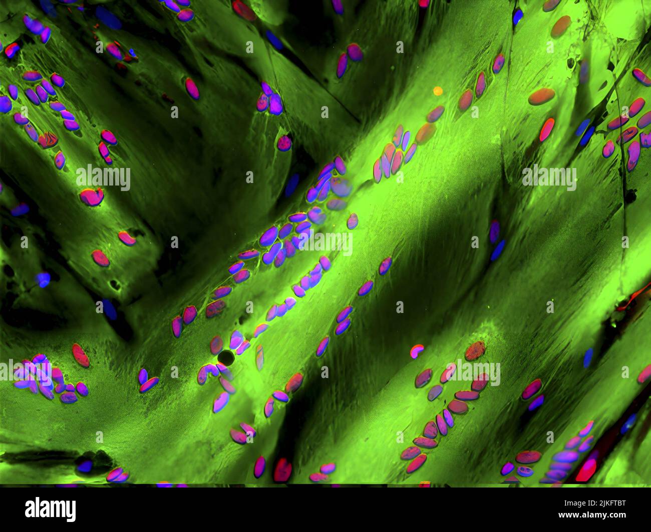 I ricercatori hanno determinato che il complesso proteico TFIID controlla i geni delle cellule staminali che riparano il muscolo scheletrico. Questa immagine mostra fibre muscolari scheletriche umane differenziate (miotubi, in verde) che proteggono la proteina MyoD (colorata in rosso), che coopera con TFIID per trasformare le cellule staminali muscolari in tessuto muscolare. I nuclei cellulari sono colorati in blu. Questa scoperta potrebbe aiutare a sviluppare strategie che attivano le cellule staminali per riparare i muscoli degenerati dall'invecchiamento o malattie come la distrofia muscolare e il cancro. Foto Stock
