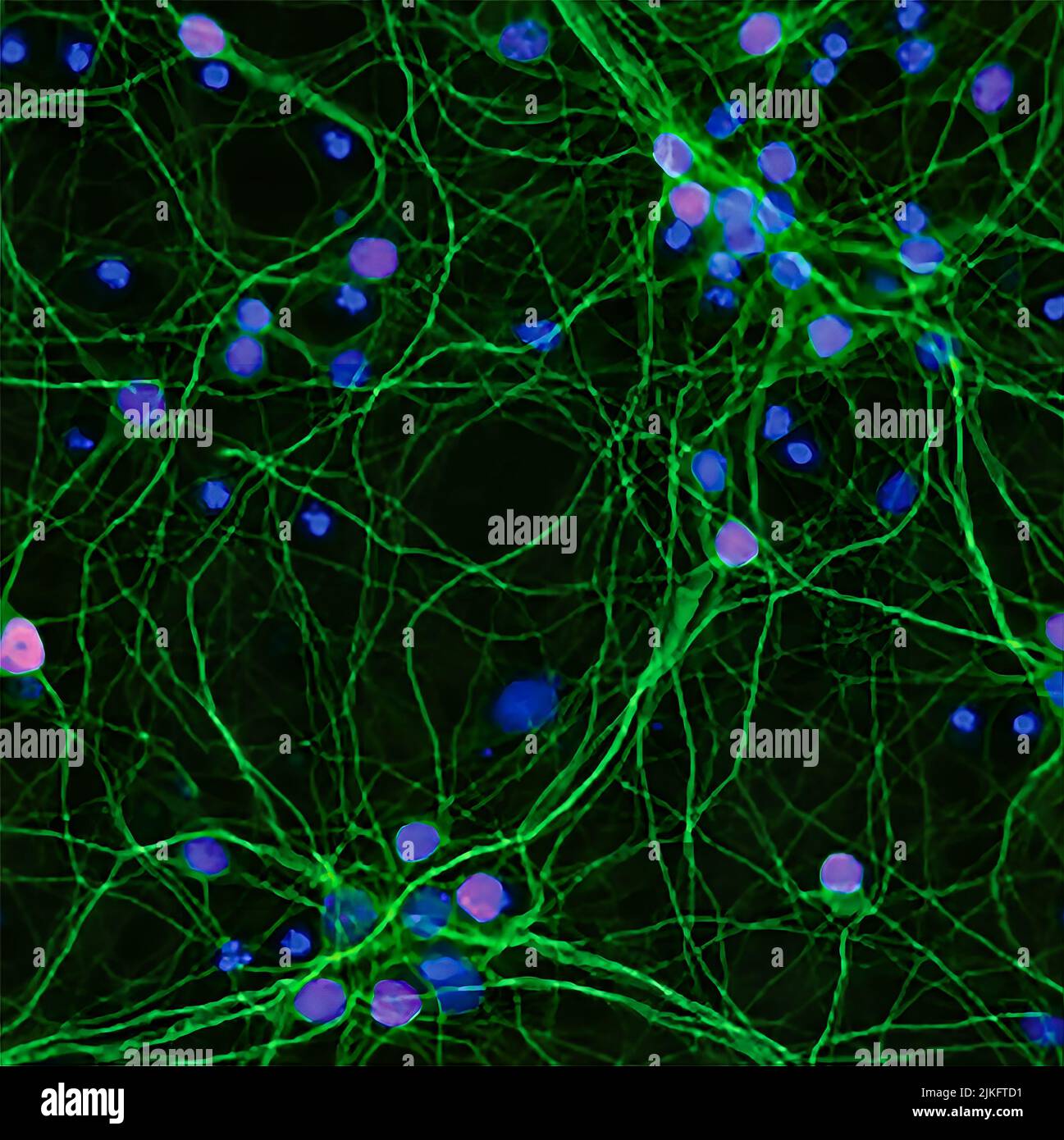I ricercatori hanno utilizzato lo strumento di editing genico CRISPR per ricercare rapidamente l'intero genoma umano per individuare i sospetti genetici dietro le versioni ereditate di ALS e FTD. Foto Stock I ricercatori hanno utilizzato lo strumento di editing genico CRISPR per ricercare rapidamente l'intero genoma umano per individuare i sospetti genetici dietro le versioni ereditate di ALS e FTD. Foto Stock
