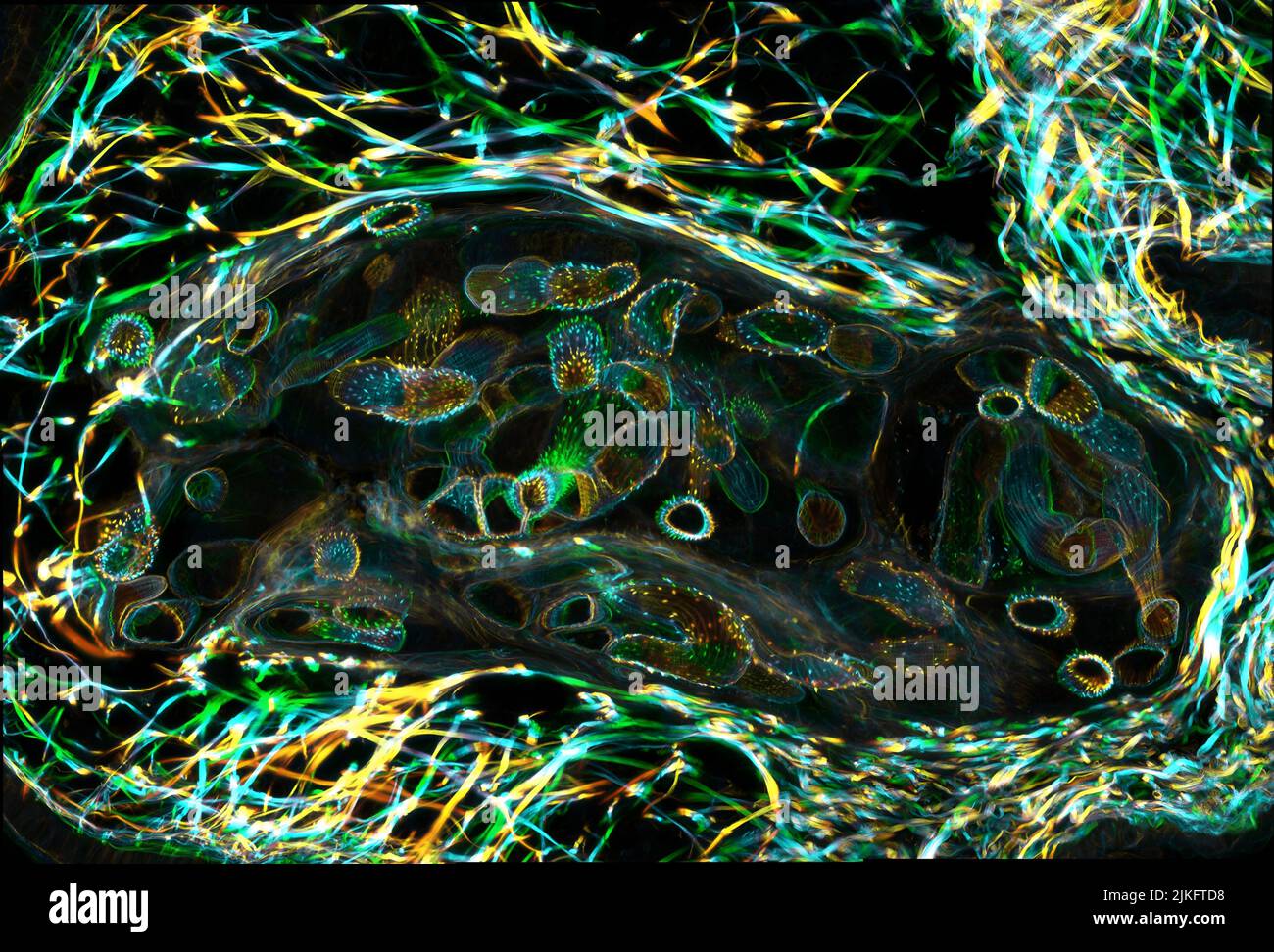 Il verme parassita che causa la schistosomiasi si schiusa in acqua e cresce in una lumaca d'acqua dolce, come mostrato qui. Una volta maturo, il verme ritorna all'acqua, dove può infettare le persone attraverso il contatto con la pelle. Inizialmente, una persona infetta può avere un'eruzione cutanea, prurito della pelle, o sintomi simil-influenzali, ma il danno reale è fatto nel tempo agli organi interni. Foto Stock