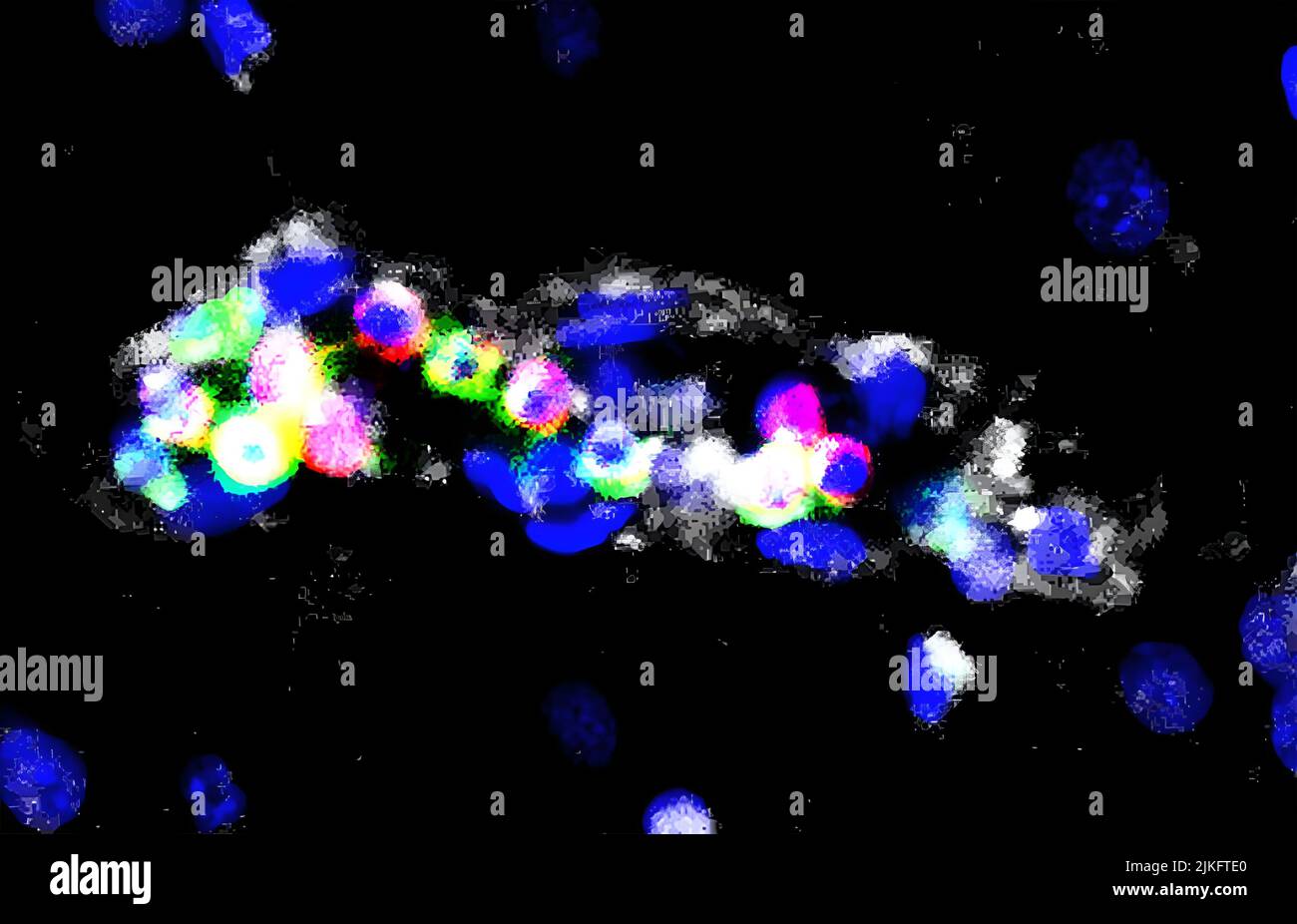 I ricercatori degli Istituti nazionali di Sanità hanno trovato prove che specifiche cellule immunitarie possono svolgere un ruolo chiave negli effetti devastanti della malaria cerebrale, una forma grave di malaria che colpisce principalmente i bambini piccoli. I risultati, pubblicati sul Journal of Clinical Investigation, suggeriscono che i farmaci mirati ai linfociti possono essere efficaci nel trattamento della malattia. Lo studio è stato sostenuto dal NIH Intramural Research Program. Foto Stock