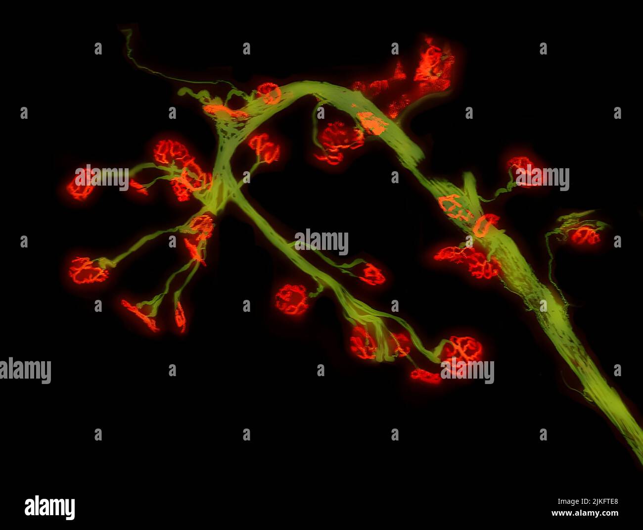 La malattia di Pompe è una malattia ereditaria rara caratterizzata dalla carenza di un enzima chiamato alfa-glucosidasi acida (GAA). Una delle principali caratteristiche della malattia di Pompe è la progressiva rottura delle comunicazioni tra cellule nervose e muscolari. Questa immagine è di un muscolo della gamba (tibialis anterior) da un modello di topo adulto della malattia di Pompe. Le cellule nervose (verdi) e i siti cellulari di comunicazione nervosa-muscolare, chiamati giunzioni neuromuscolari, (rosse) sono marcati fluorescentemente per osservare il continuo deterioramento delle giunzioni neuromuscolari. Foto Stock