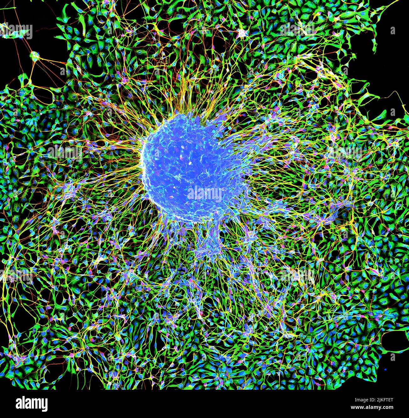 E citaPerchè la foto vincitrice del Cool Science Image Contest 2015 di Scott Vermilyea, programma di formazione Neuroscience, Scuola di Medicina e Sanità pubblica e Scott Guthrie Undergraduate Neurobiology, con i membri SCRMC Ted Golos e Marina Emborg, professori presso la School of Medicine and Public Health e il Wisconsin National Primate Research Center. Golos è anche membro della facoltà della Scuola di Medicina veterinaria. Foto Stock