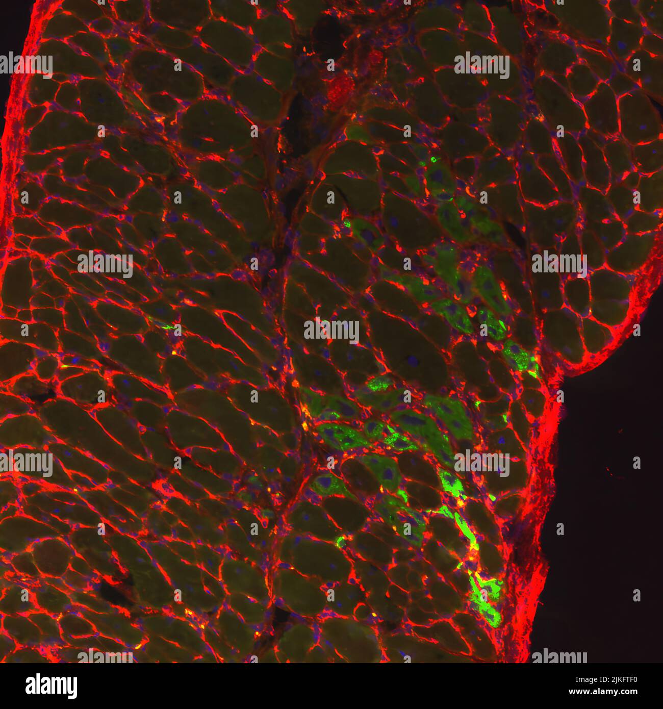 Muscolo diaframmatico da un topo carente di distrofina trattato con SU9516 nuclei (blu), miofibre (scatolato in rosso) e fibre muscolari rigeneranti (verde). Foto Stock