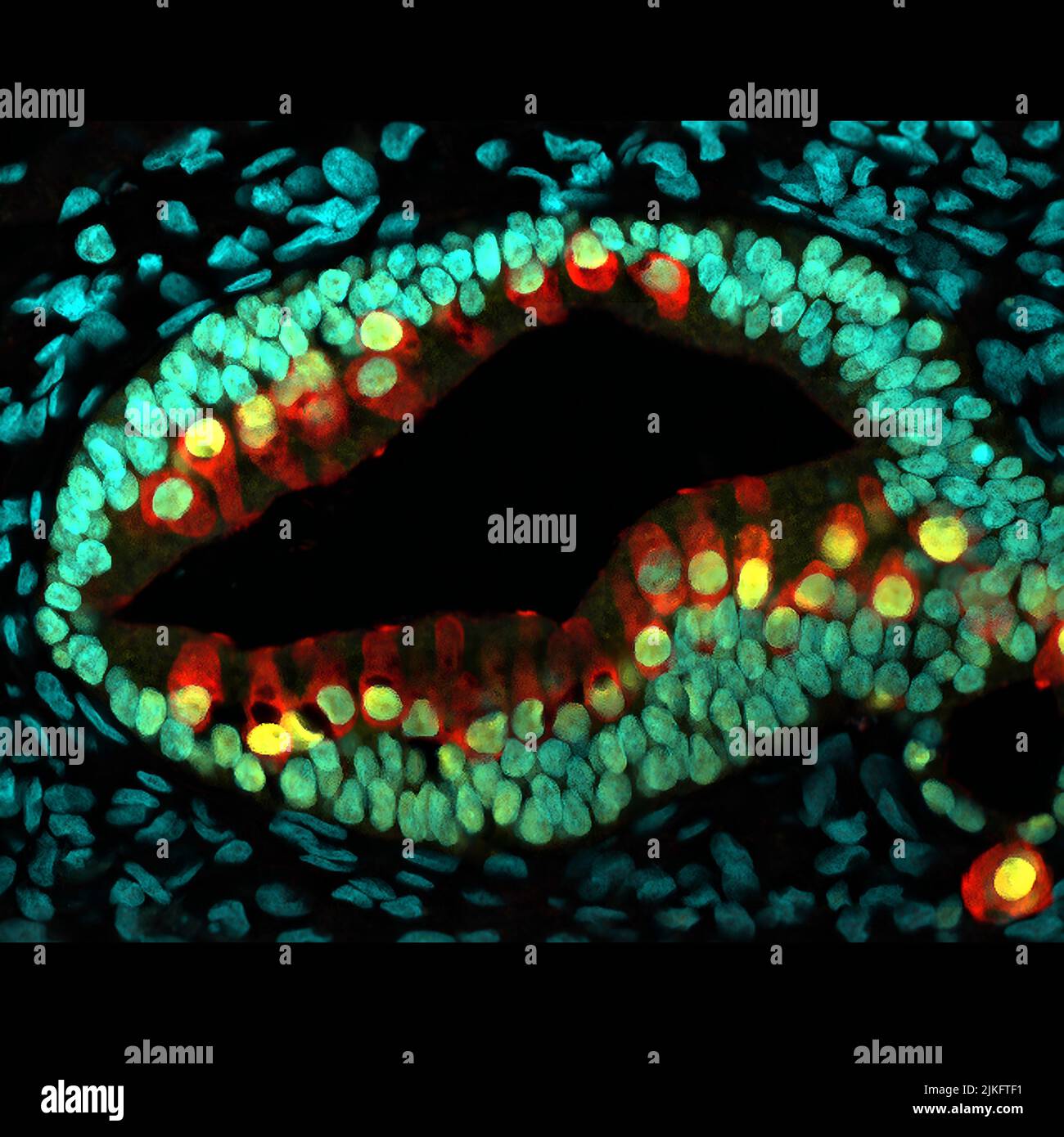 Una sezione trasversale di un orecchio interno 'organoide,' o mini orecchio interno, creato da cellule staminali umane. Le cellule acustiche (rosse) dell'orecchio interno sono ricoperte da fasci di cellule (gialle). Gli organoidi dell'orecchio potrebbero consentire ai ricercatori di modellare e testare facilmente le terapie per i disturbi dell'udito e dell'equilibrio. Foto Stock