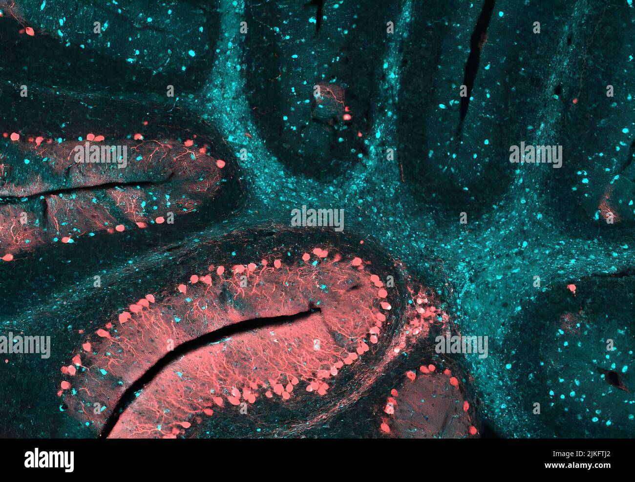 Il cervelletto di un cervello di topo affetto da Niemann-Pick di tipo C (NPC), un raro disturbo neurologico. I ricercatori NIH stanno conducendo gli studi per i trattamenti avanzati per le malattie rare e le malattie rare simili. Foto Stock