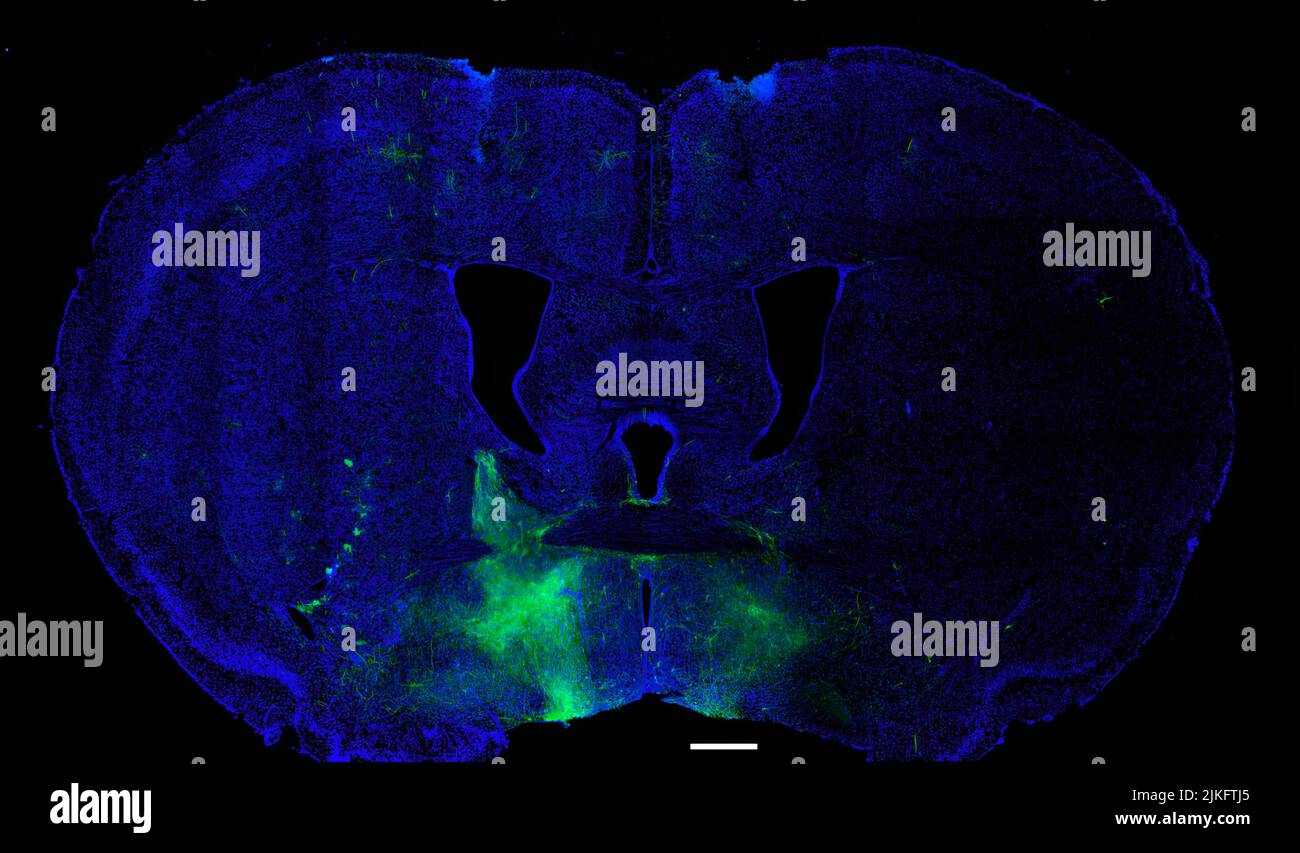 I ricercatori hanno identificato le connessioni tra i neuroni nei sistemi cerebrali associati con ricompensa, stress ed emozione. Condotto su topi, il nuovo studio potrebbe aiutare a svelare diversi disturbi psichiatrici, tra cui disturbi dell'uso di alcol, disturbi d'ansia, insonnia e depressione negli esseri umani. Foto Stock