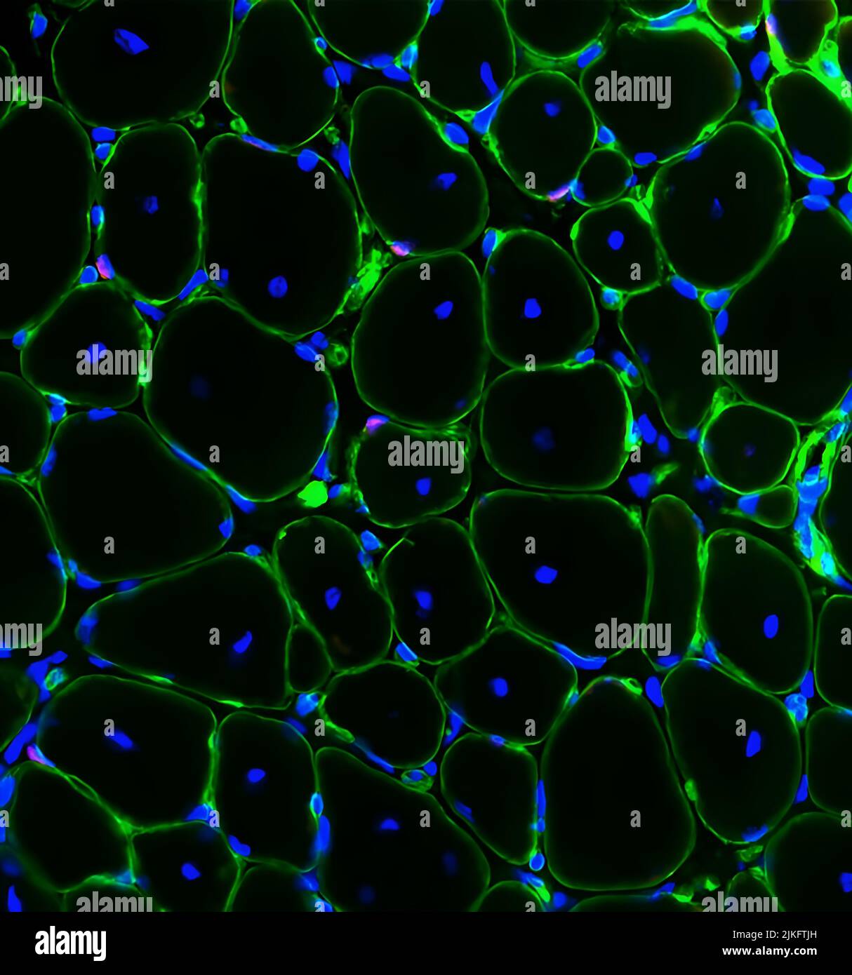 Questa sezione trasversale del muscolo rigenerato mostra le cellule staminali del muscolo (rosse) nella loro nicchia lungo le fibre del muscolo (verdi). I punti blu sono il DNA nei nuclei delle fibre. I ricercatori hanno scoperto che l'iniezione della prostaglandina molecolare E2 nei muscoli dopo la lesione induce la divisione delle cellule staminali muscolari e accelera la rigenerazione. La prostaglandina E2 è una molecola infiammatoria rilasciata in risposta a lesioni muscolari o a un esercizio rigoroso. Foto Stock