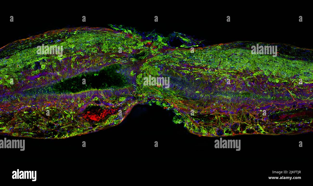 Sezione di tessuto del midollo spinale Zebrafish che si rigenera dopo lesione. Le celle gliali (rosse) attraversano prima lo spazio tra le estremità tagliate. Le celle neurali (verdi) seguono presto. I nuclei cellulari sono colorati di blu e viola. Foto Stock